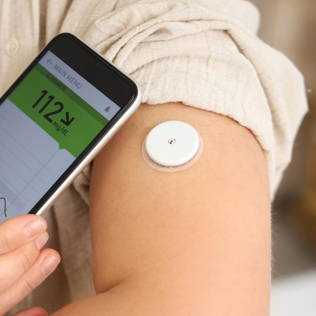 Using Continuous Glucose Monitors (CGMs) to Optimize Fat Burning